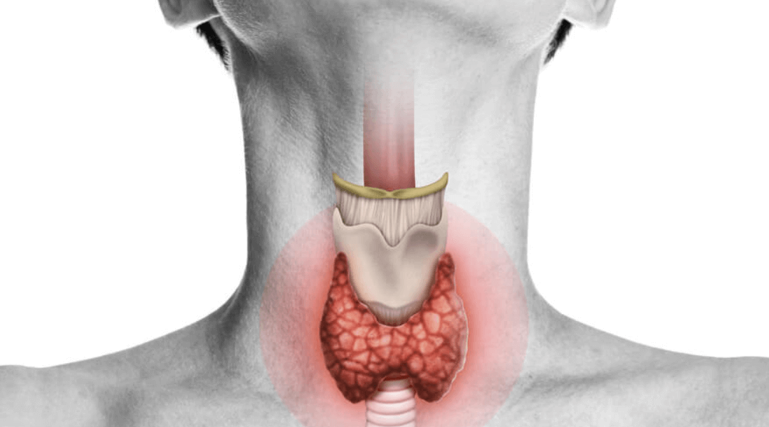 Hashimotos’ thyroiditis: Epidemiology, pathogenesis, clinic and therapy